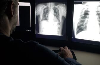 Lung Energy Peaks in Our 20s—and It is a Regular Decline From There, Research Finds