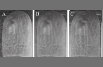 Your Pruney Fingers After After a Bathtub All the time Wrinkle the Similar Means, Examine Reveals